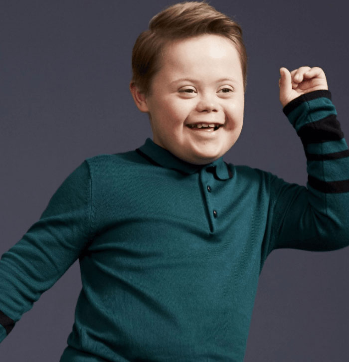 The extra chromosome does not make them strangers.